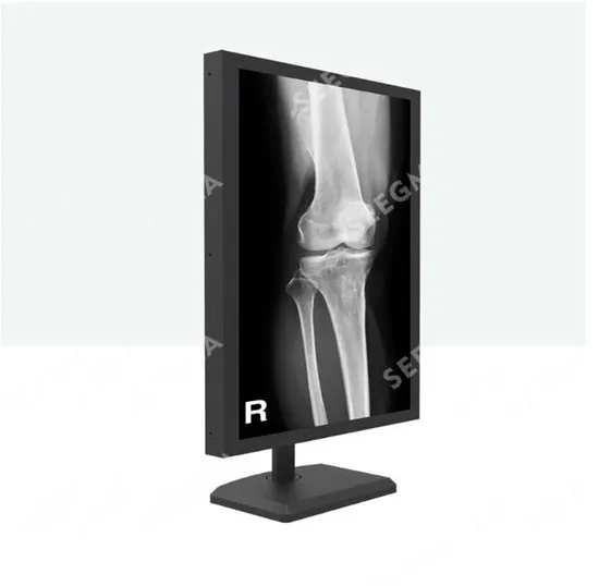 5MP X Ray Medical 21.3